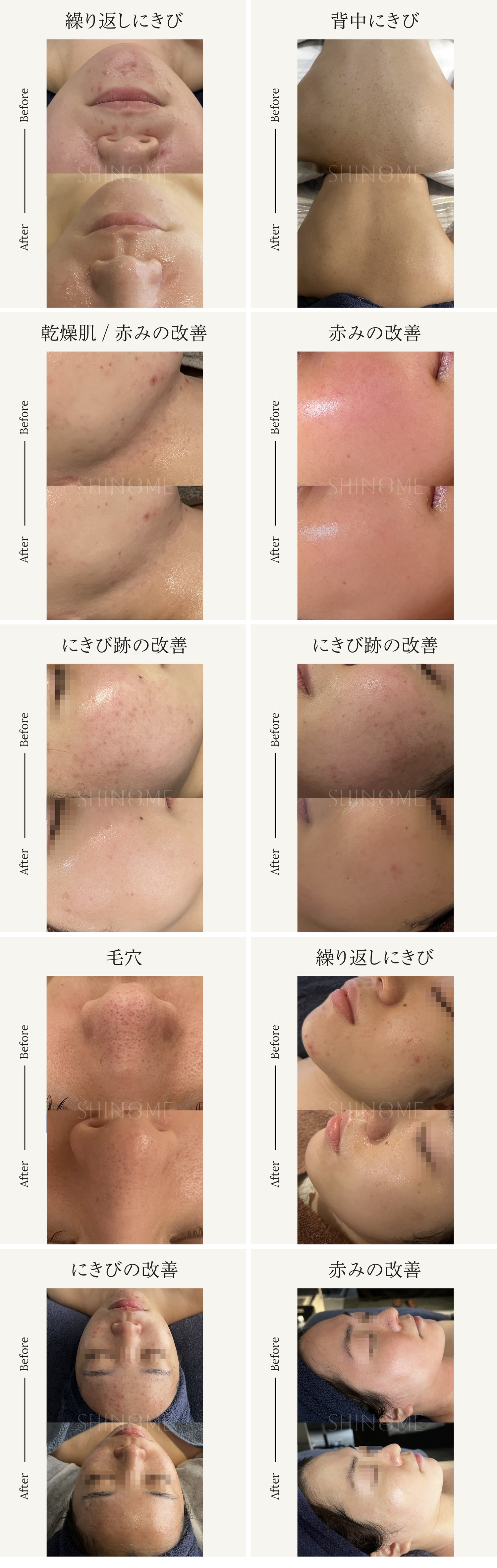 【お得なキャンペーン企画】クリスティーナ ５回券